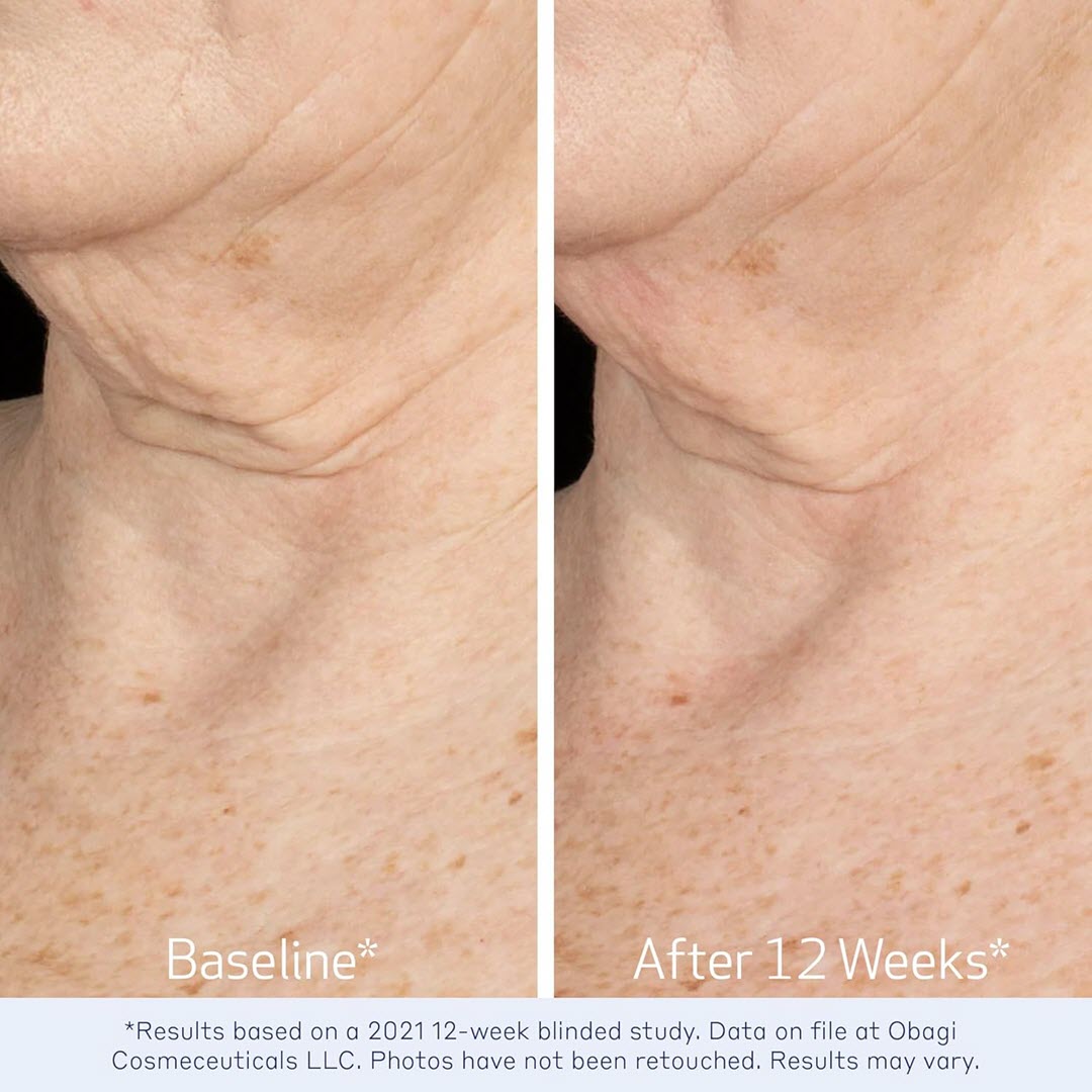 OBAGI® ELASTIderm® Neck and Décolleté Concentrate