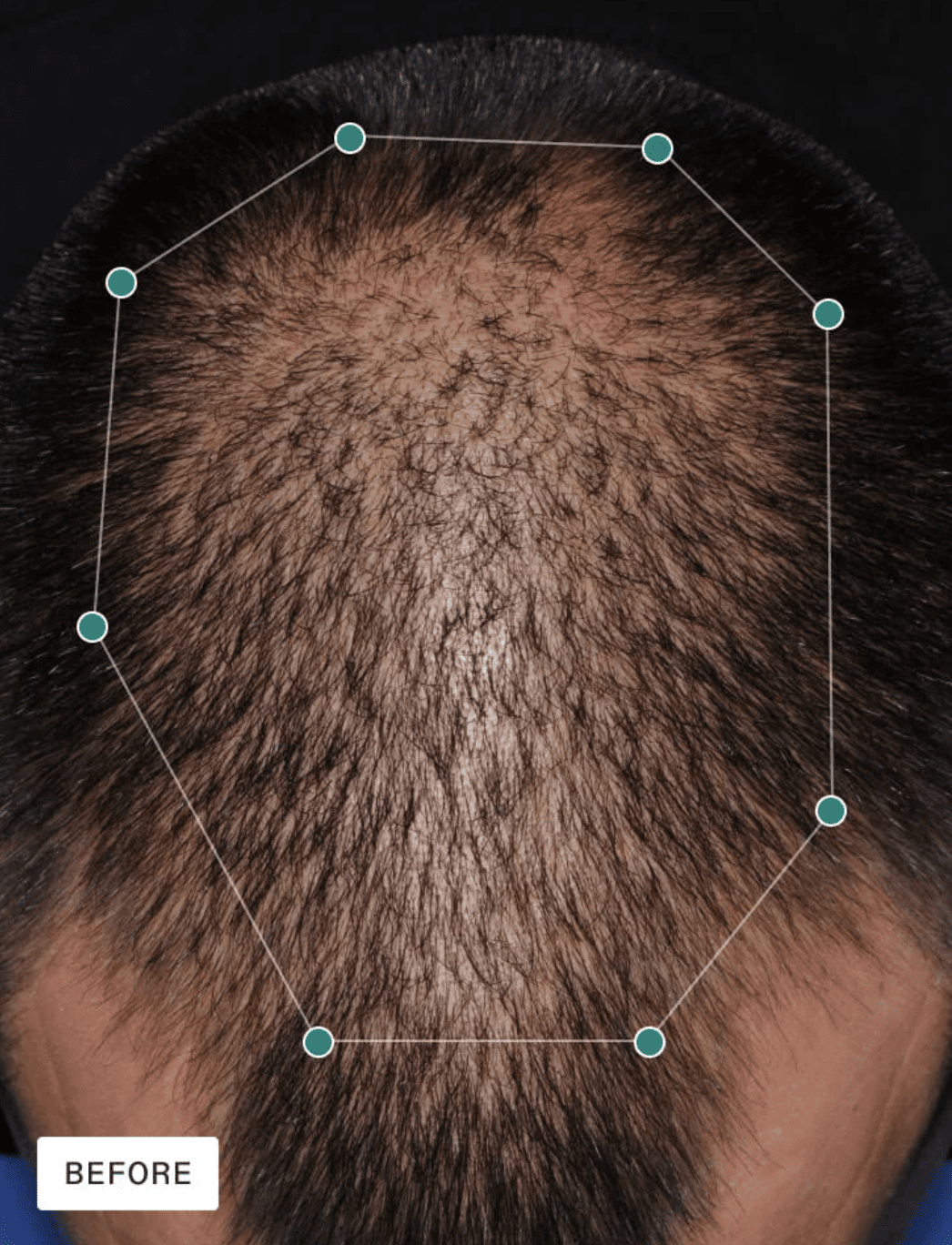 Nutrafol 	Men's Hair Growth - 30 Day Supply