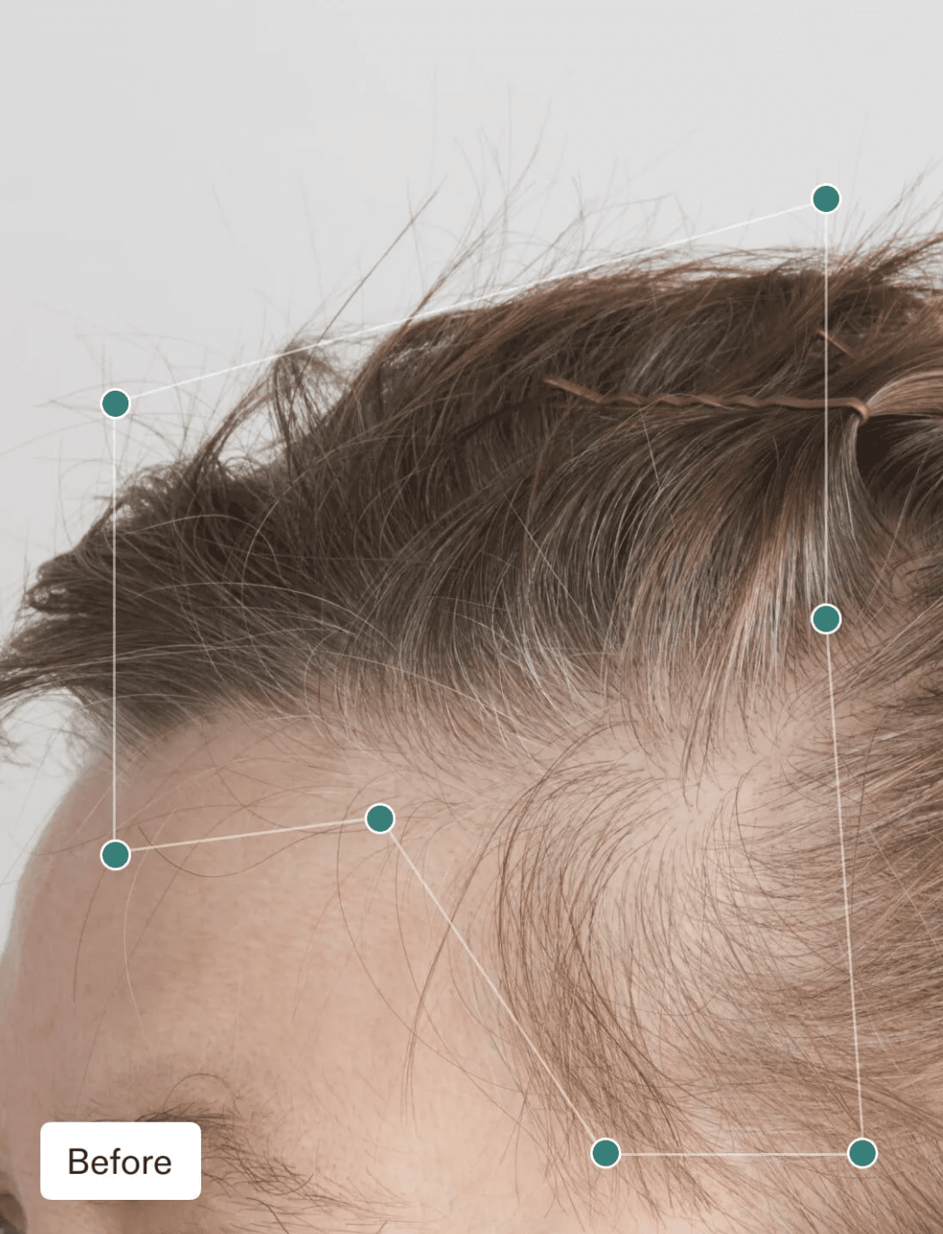 Nutrafol Women's Balance Hair Growth - 30 Day Supply