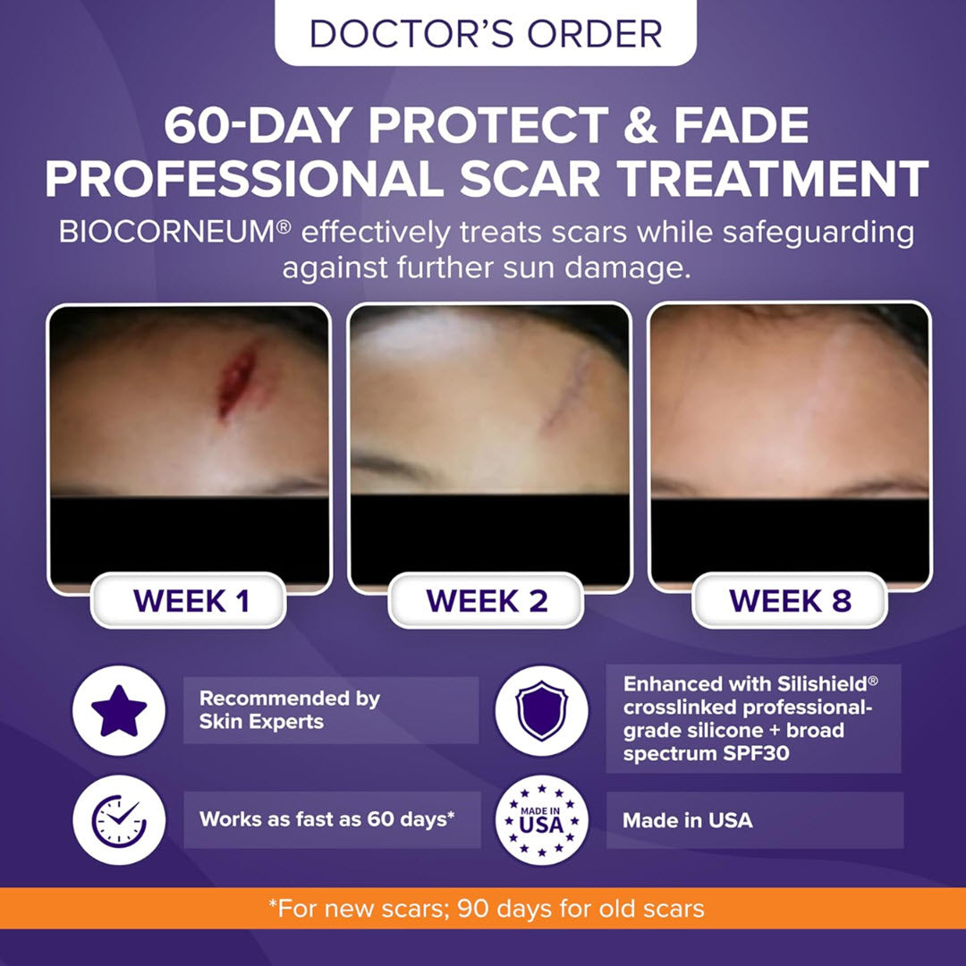 Biocorneum® Advanced Scar Treatment with Silishield® & SPF 30 10g