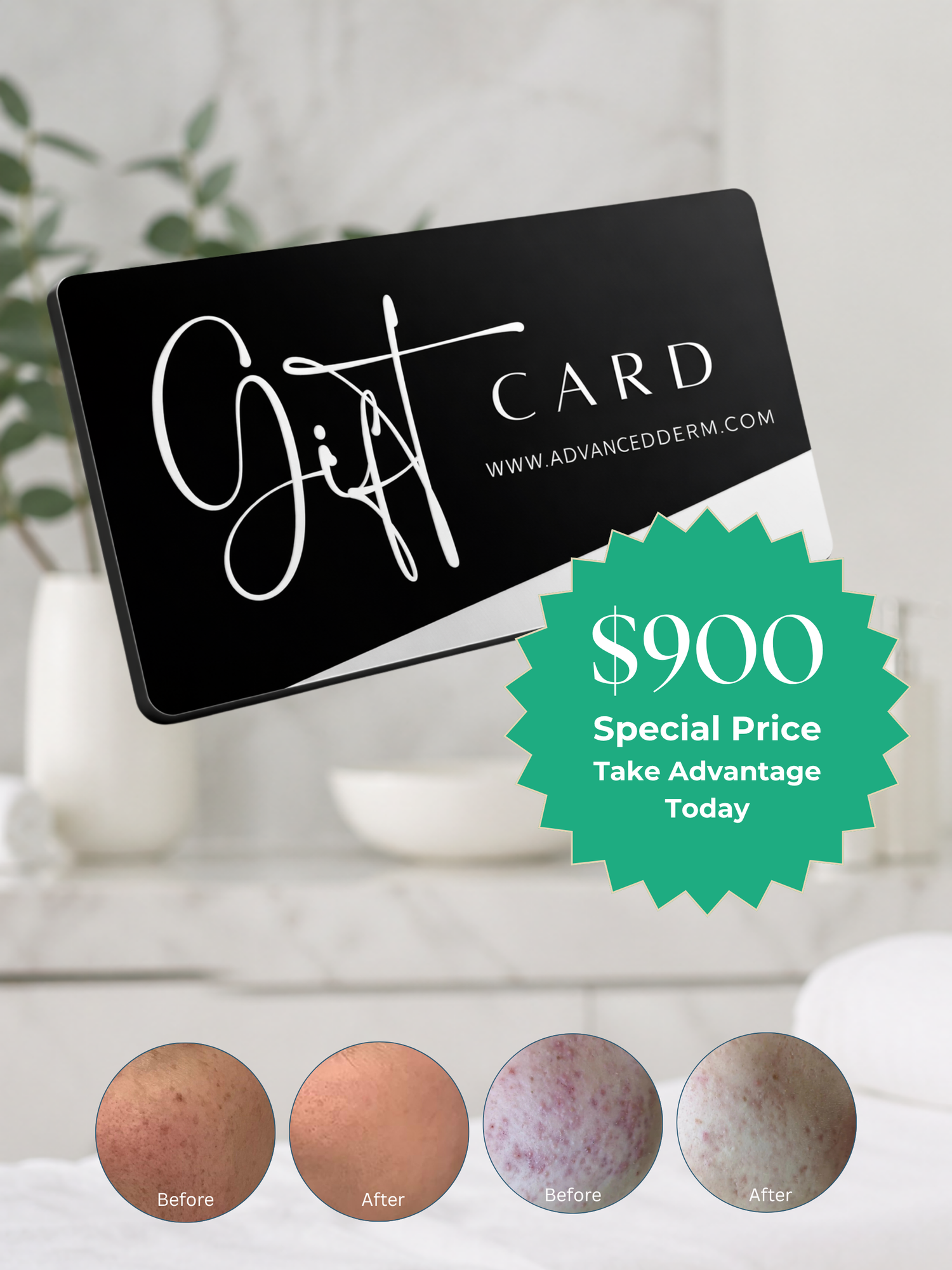 Series of 4 BioRePeel Treatments - Physical Gift Card