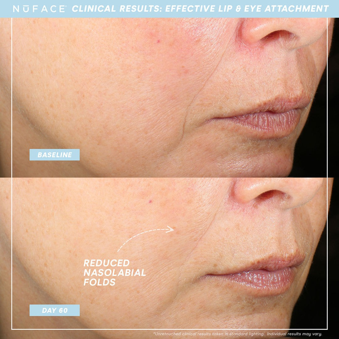 NuFace® Trinity+ Effective Lip and Eye Attachment