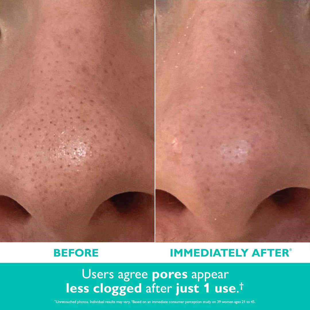 Peter Thomas Roth® Even Smoother Microdermabrasion Exfoliating Pore Purifier 1.7oz / 50ml