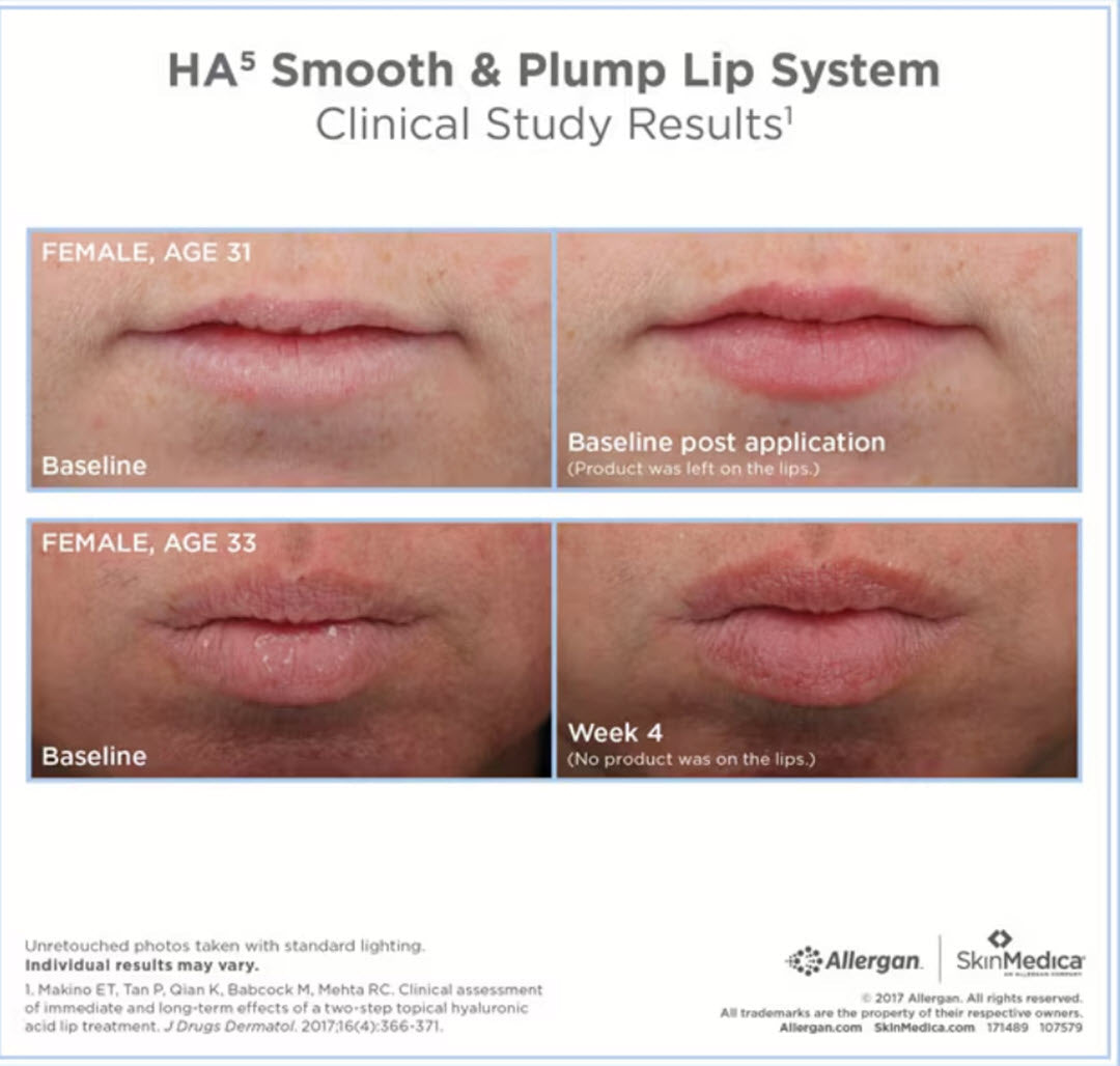 SkinMedica® HA5 Smooth & Plump Lip System 2-Piece Set