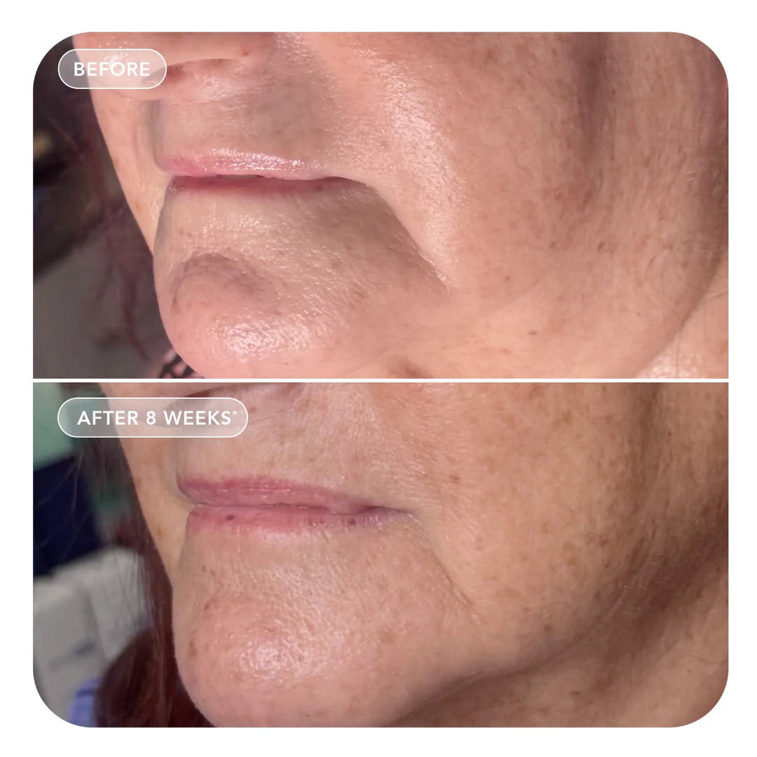 VOL.U.LIFT GLP-1 4D Skin Rebound Complex IMAGE Skincare