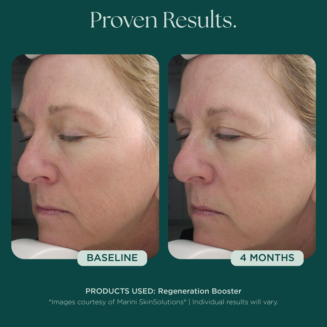 Marini Regeneration Booster Face Lotion | Advanced Dermatology