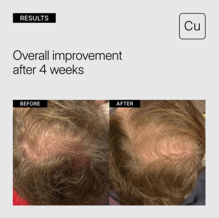 Neova® Tricomin Hair Strengthening System