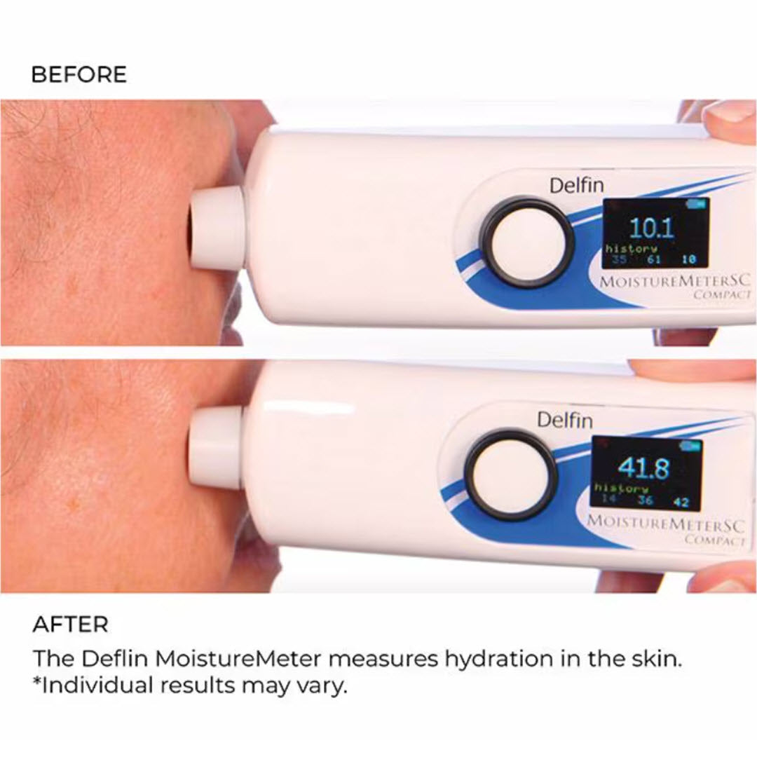 Delfin MoistureMeter reading before and after NassifMD 3HA Facial Mist showing increased skin hydration