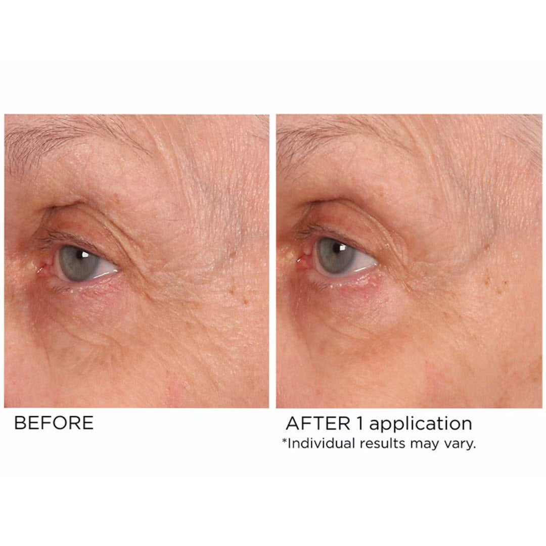 Before and after 1 application of NassifMD Age Defying Eye Renewal Serum on under-eye fine lines