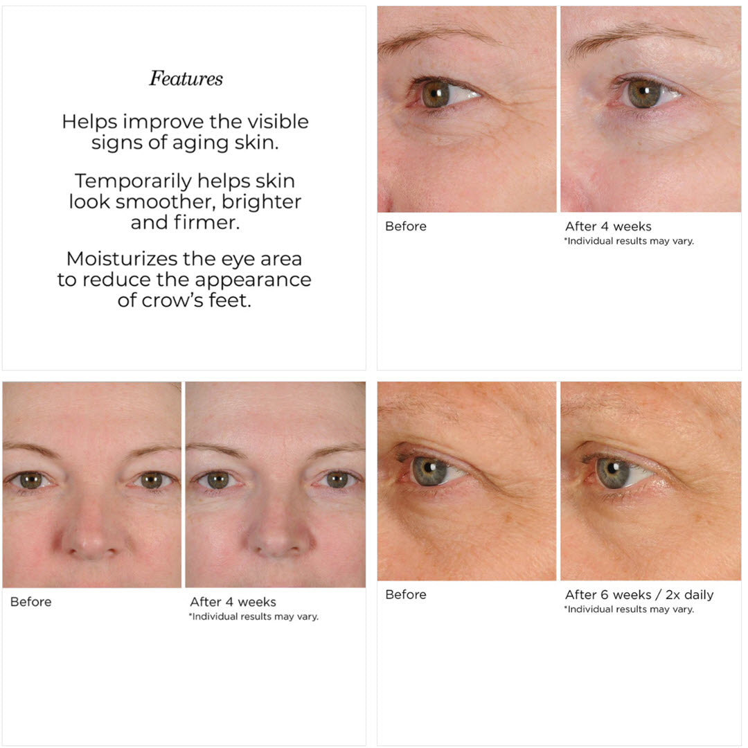 NassifMD Peri-Orbital Eye Creme features and 3 separate before/after clinical photos of eye area smoothness and crow's feet at 4 and 6 weeks
