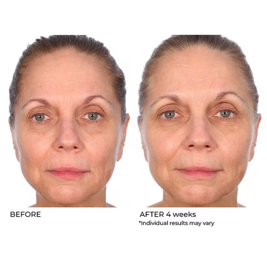 Before and after 4 weeks use of NassifMD Radiance Brightening Vitamin C Booster on full face brightness and fine lines