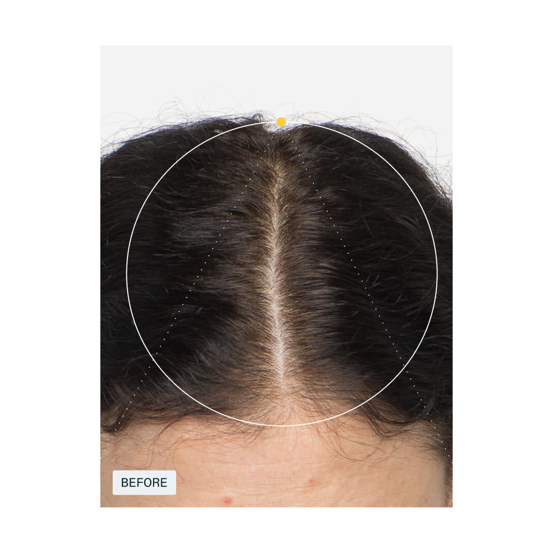 Nutrafol® Women Hair Growth Supplements Nutraceutical - 1-Month Supply