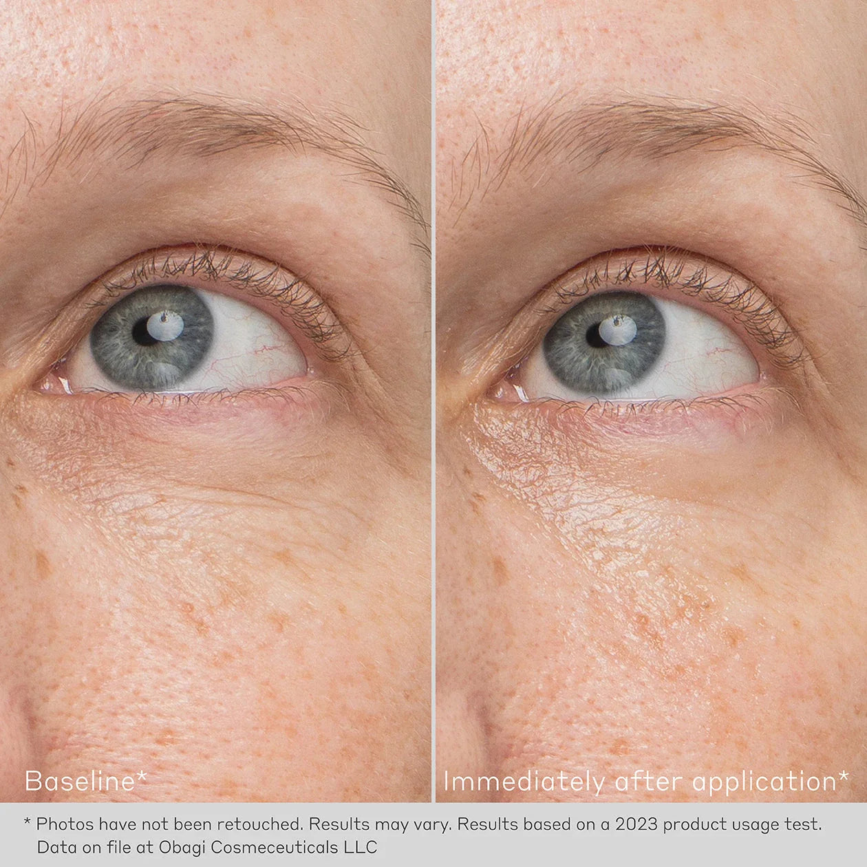 OBAGI® Daily Hydro-Drops Rejuvenating Eye Gel Cream