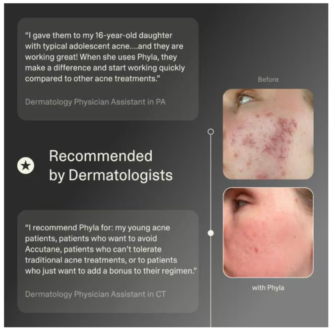 Phyla® Acne Phage Serum 1 fl oz.