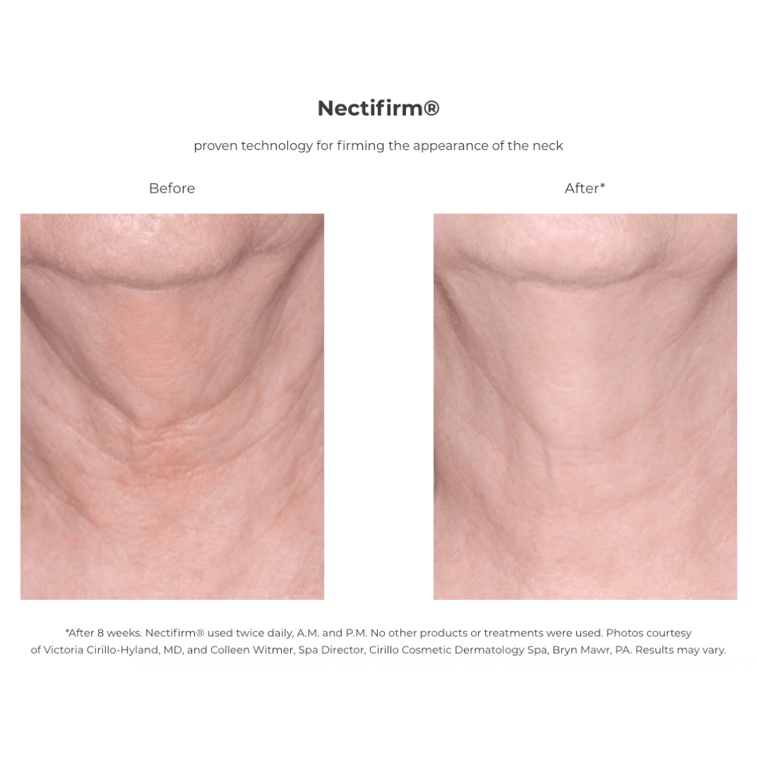 Revision Skincare Nectifirm before and after showing firmer neck appearance