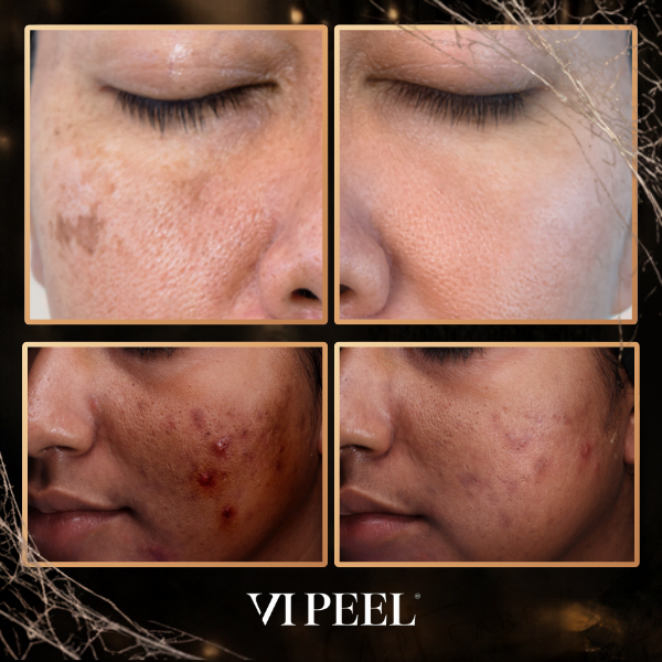 VI Peel® Purify with Precision + Peptides Physical Gift Card