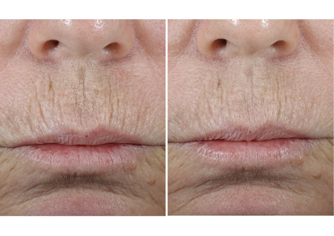 SkinMedica® Total Defense + Repair SPF 34 / PA ++++ Sunscreen 2.3 oz / 65 g