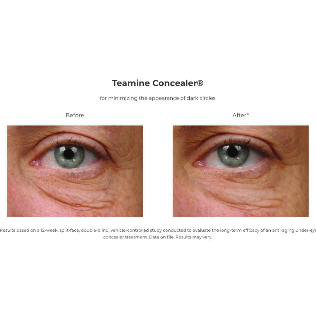 Revision® Teamine® Eye Complex 0.5 oz