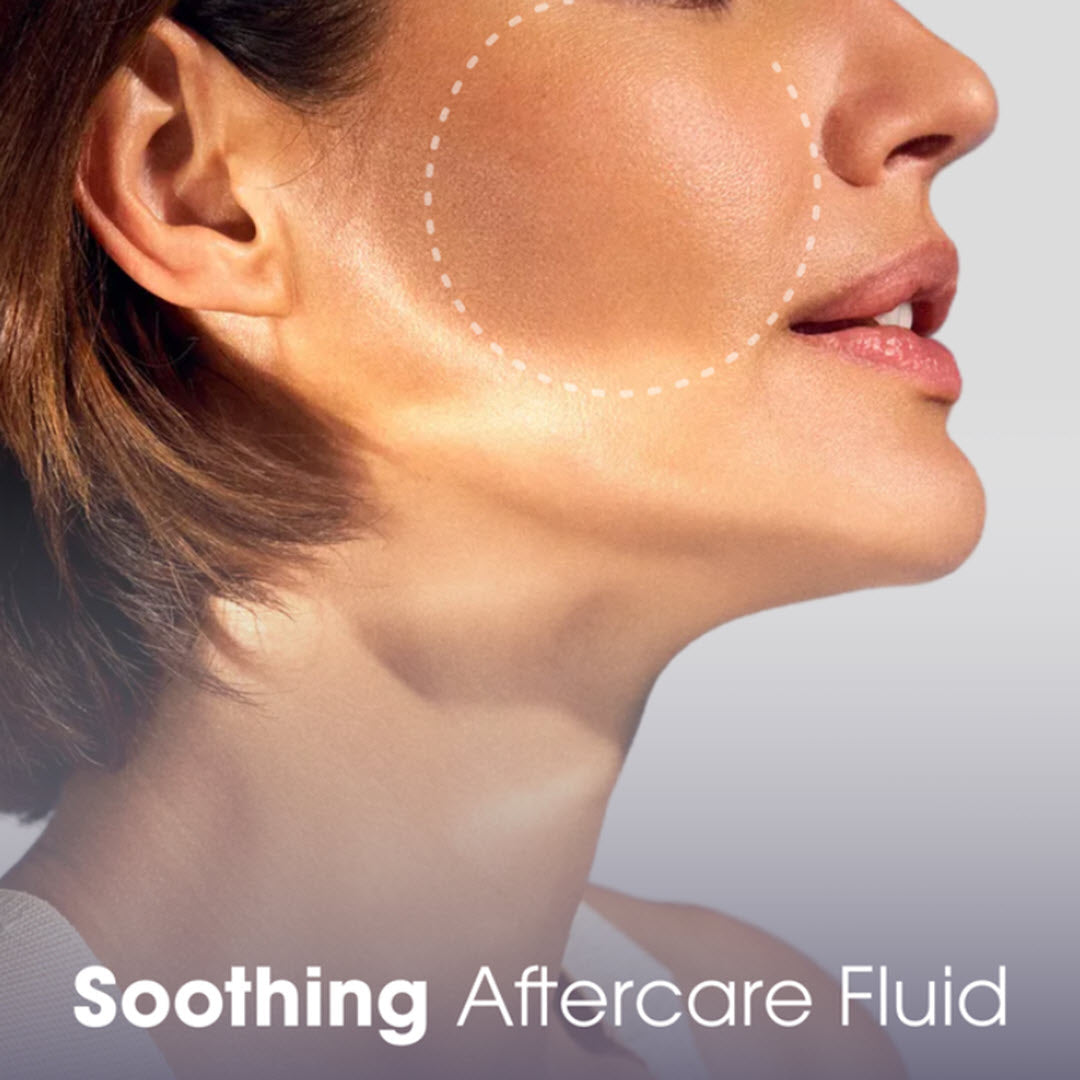 Close-up of woman's cheek highlighting the treated area soothed by Teoxane Post Procedure Aftercare Fluid