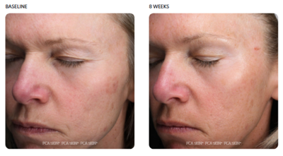 Treatment photo