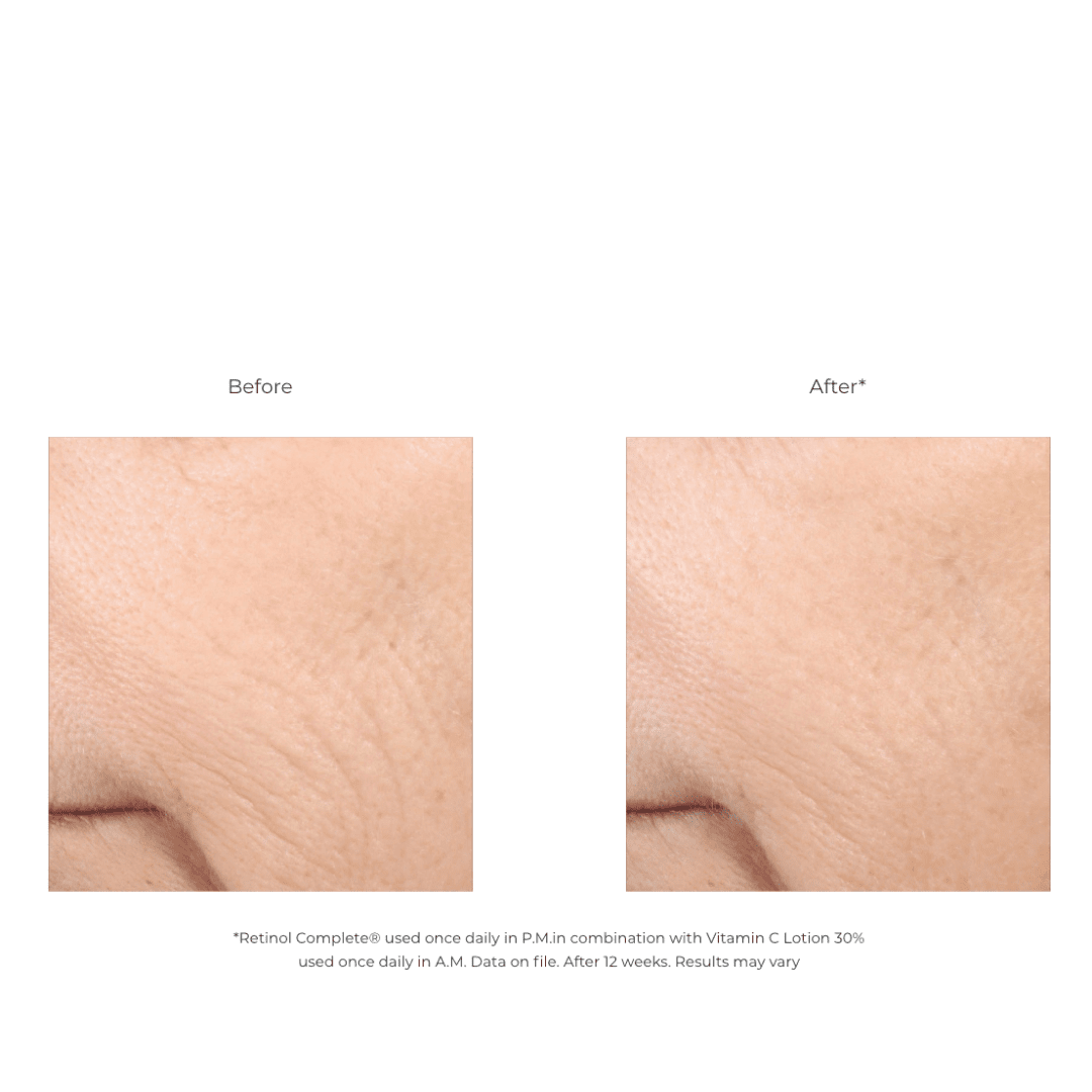 Revision® C+ Brightening Eye Complex 0.5 OZ