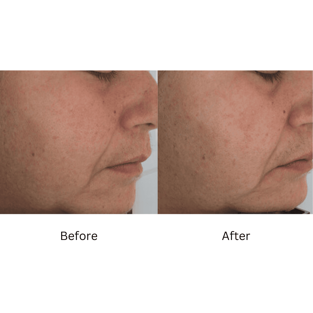ZO® Skin Health Firming Serum 1.6 Fl. Oz. – Advanced Dermatology