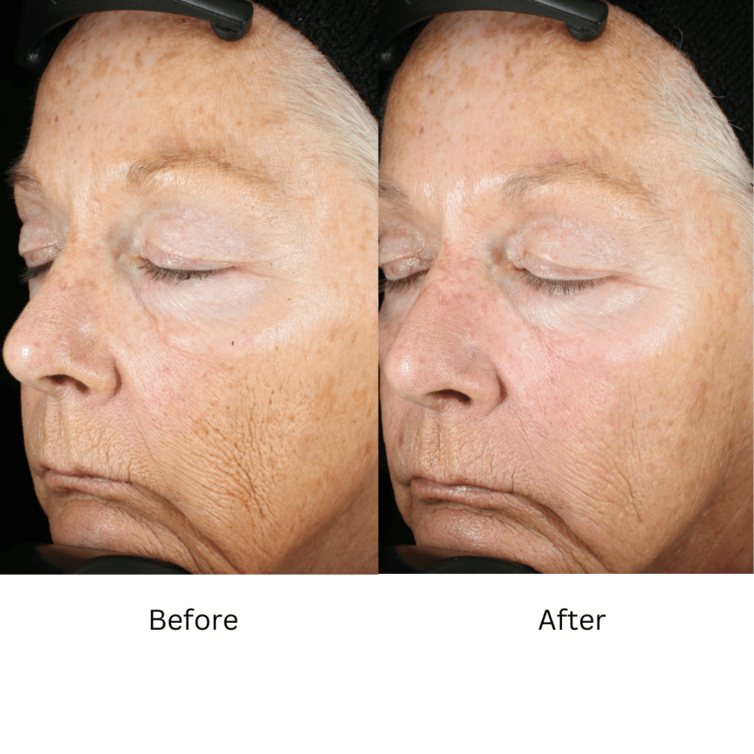 ZO® Skin Health Wrinkle + Texture Repair 1.7 Fl. Oz. – Advanced