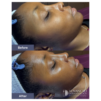 Treatment photo