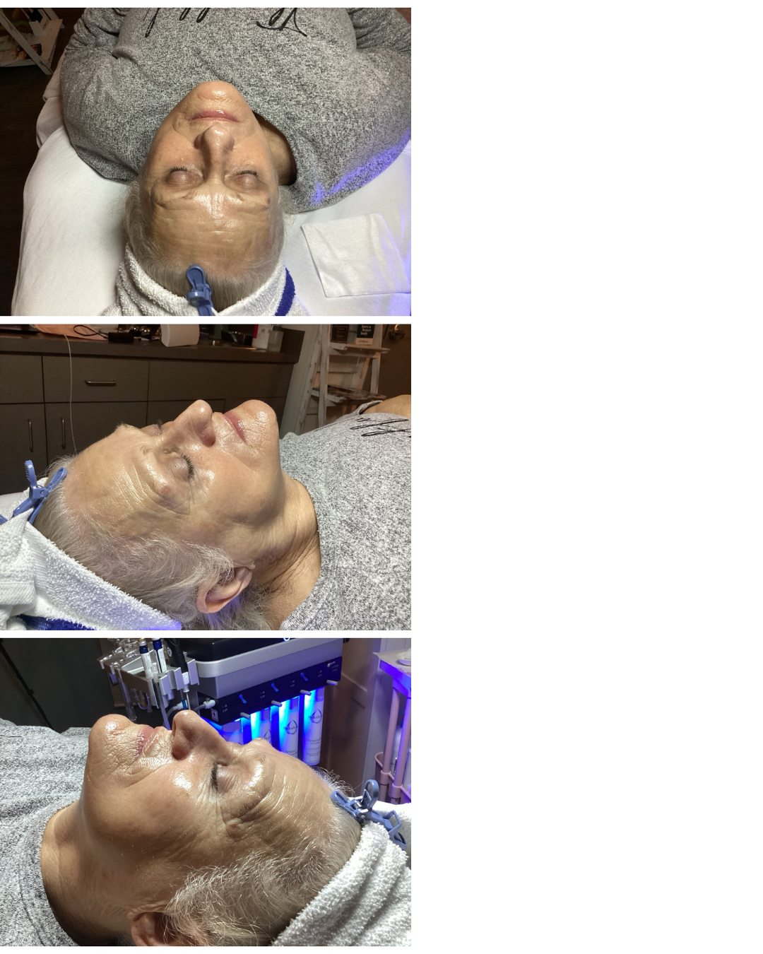 HydraFacial™ Deluxe + Growth Factor Gift Card