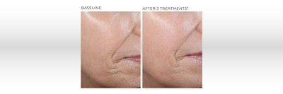 Treatment photo
