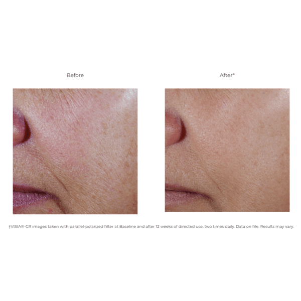 Revision® C+ Correcting Complex 30% - Advanced Dermatology