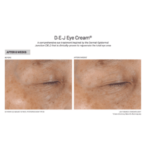 D.E.J Eye Cream® B&A3