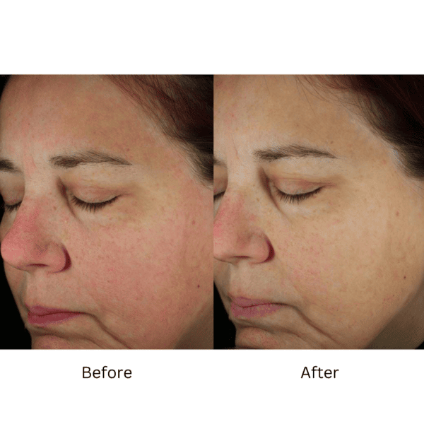 ZO® Daily Power Defense - Advanced Dermatology and Cosmetic